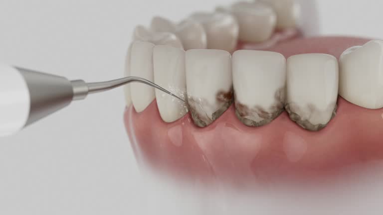 Reliable Dental Implants contractor in Pleasant View, TN by Smile Center Dentistry